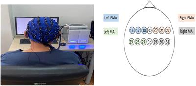 Variation in brain connectivity during motor imagery and motor execution in stroke patients based on electroencephalography